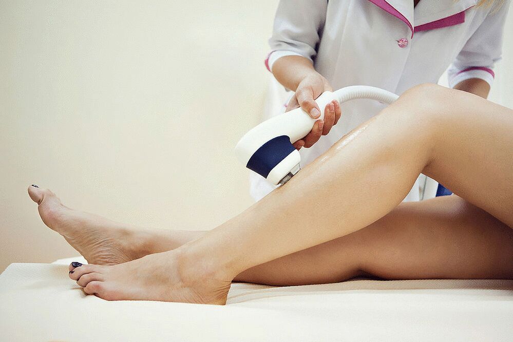 Pretition for varicose veins